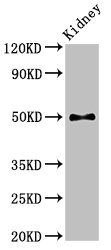 PDK1 Antibody - Positive Western Blot detected in Mouse kidney tissue. All lanes: PDK1 antibody at 2.8 µg/ml Secondary Goat polyclonal to rabbit IgG at 1/50000 dilution. Predicted band size: 50, 52 KDa. Observed band size: 50 KDa