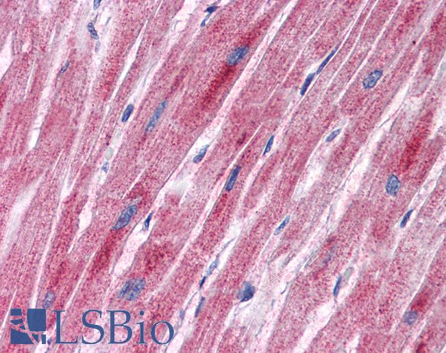 PDK2 Antibody - Anti-PDK2 antibody IHC of human heart. Immunohistochemistry of formalin-fixed, paraffin-embedded tissue after heat-induced antigen retrieval. Antibody concentration 5 ug/ml.  This image was taken for the unconjugated form of this product. Other forms have not been tested.