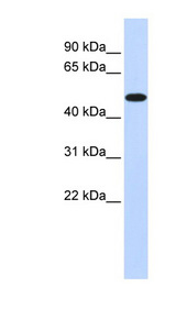 PDK2 Antibody - PDK2 antibody Western blot of 293T cell lysate. This image was taken for the unconjugated form of this product. Other forms have not been tested.