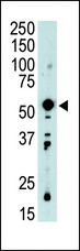 PDK2 Antibody - Western blot of PDK2 Antibody in mouse intestine tissue lysate (35 ug/lane). PDK2 (arrow) was detected using the purified antibody.