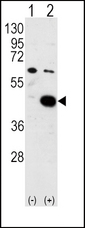 PDK2 Antibody - Western blot of PDK2 (arrow) using PDK2 Antibody. 293 cell lysates (2 ug/lane) either nontransfected (Lane 1) or transiently transfected with the PDK2 gene (Lane 2) (Origene Technologies).
