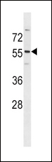PDK2 Antibody - PDK2 Antibody (C392) western blot of HeLa cell line lysates (35 ug/lane). The PDK2 antibody detected the PDK2 protein (arrow).