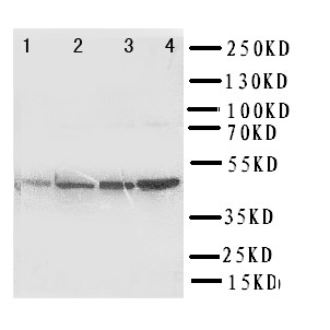 PDK2 Antibody - WB of PDK2 antibody. Lane 1: Rat Heart Tissue Lysate. Lane 2: HELA Cell Lysate. Lane 3: SW620 Cell Lysate. Lane 4: MCF-7 Cell Lysate..
