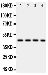 PDK2 Antibody - Anti-PDK2 antibody, Western blotting Lane 1: Rat Heart Tissue LysateLane 2: HELA Cell LysateLane 3: SW620 Cell LysateLane 4: MCF-7 Cell Lysate