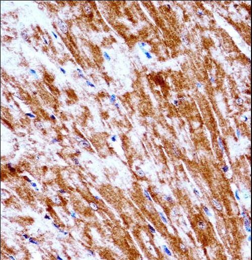 PDK2 Antibody - Mouse Pdk2 Antibody immunohistochemistry of formalin-fixed and paraffin-embedded mouse heart tissue followed by peroxidase-conjugated secondary antibody and DAB staining.