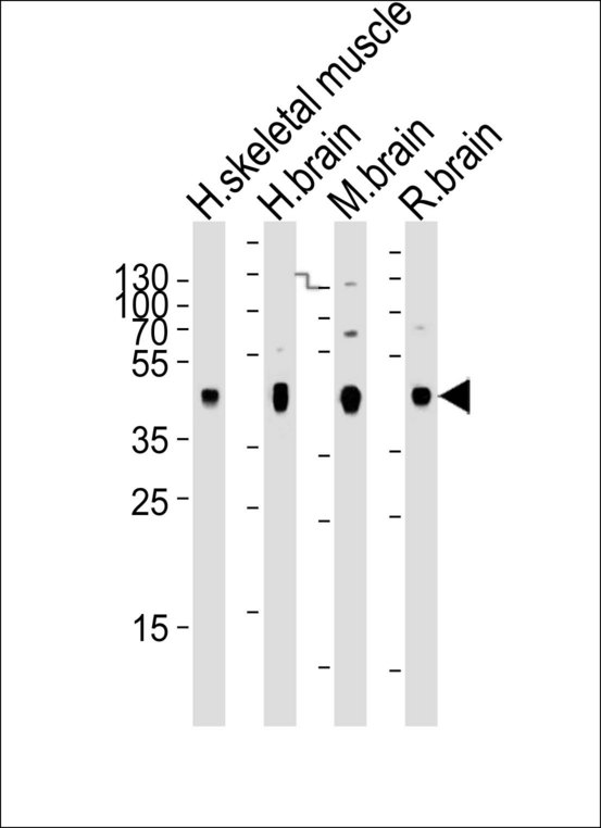 PDK2 Antibody - Western blot of lysates from human skeletal muscle, human brain, mouse brain, rat brain tissue (from left to right), using PDK2 Antibody. Antibody was diluted at 1:2000 at each lane. A goat anti-mouse IgG H&L (HRP) at 1:3000 dilution was used as the secondary antibody. Lysates at 20ug per lane.