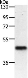 PDK2 Antibody - Western blot analysis of Mouse heart tissue, using PDK2 Polyclonal Antibody at dilution of 1:500.