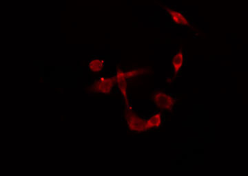 PDK2 Antibody - Staining HepG2 cells by IF/ICC. The samples were fixed with PFA and permeabilized in 0.1% Triton X-100, then blocked in 10% serum for 45 min at 25°C. The primary antibody was diluted at 1:200 and incubated with the sample for 1 hour at 37°C. An Alexa Fluor 594 conjugated goat anti-rabbit IgG (H+L) antibody, diluted at 1/600, was used as secondary antibody.