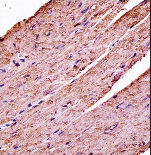 PDK3 Antibody - Mouse Pdk3 Antibody immunohistochemistry of formalin-fixed and paraffin-embedded mouse heart tissue followed by peroxidase-conjugated secondary antibody and DAB staining.