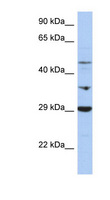 PDK3 Antibody - PDK3 antibody Western blot of OVCAR-3 cell lysate. This image was taken for the unconjugated form of this product. Other forms have not been tested.