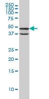 PDK3 Antibody - PDK3 monoclonal antibody (M01), clone 2B11 Western Blot analysis of PDK3 expression in MCF-7.