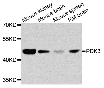 PDK3 Antibody - Western blot blot of extracts of various cells, using PDK3 antibody.
