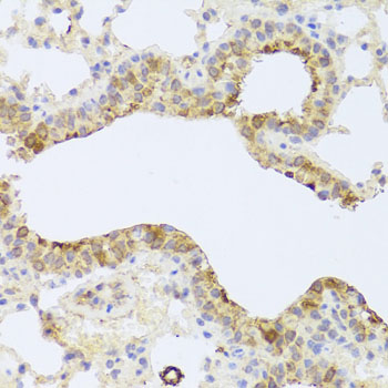 PDK3 Antibody - Immunohistochemistry of paraffin-embedded mouse lung using PDK3 antibody at dilution of 1:100 (x40 lens).