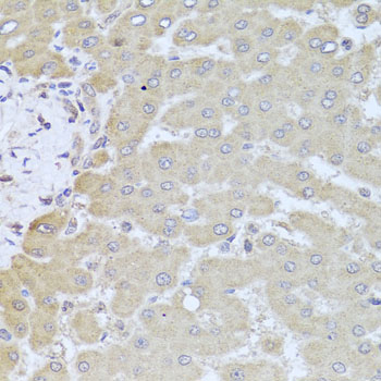 PDK3 Antibody - Immunohistochemistry of paraffin-embedded human liver injury using PDK3 antibody at dilution of 1:100 (x40 lens).