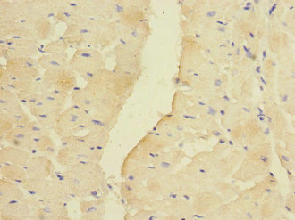 PDK3 Antibody - Immunohistochemistry of paraffin-embedded human heart tissue at dilution 1:100