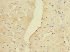 PDK3 Antibody - Immunohistochemistry of paraffin-embedded human heart tissue at dilution 1:100