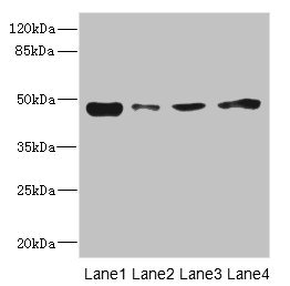 PDK3 Antibody - Western blot All Lanes: PDK3 antibody at 1.6ug/ml Lane 1: Mouse skeletal muscle tissue Lane 2: Monocytic leukemia cells in mice Macrophages Lane 3: A431 whole cell lysate Lane 4: HepG-2 whole cell lysate Secondary Goat polyclonal to rabbit IgG at 1/10000 dilution Predicted band size: 47,49 kDa Observed band size: 47 kDa