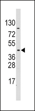 PDK4 Antibody - Western blot of PDK4 Antibody (E265) in CEM cell line lysates (35 ug/lane). PDK4 (arrow) was detected using the purified antibody.