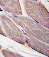 PDK4 Antibody - Formalin-fixed and paraffin-embedded human skeletal muscle tissue reacted with PDK4-E265, which was peroxidase-conjugated to the secondary antibody, followed by DAB staining. This data demonstrates the use of this antibody for immunohistochemistry; clinical relevance has not been evaluated.
