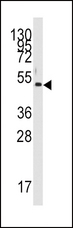 PDK4 Antibody - Western blot of anti-PDK4 Antibody (Center D98) in HL60 cell line lysates (35 ug/lane). PDK4(arrow) was detected using the purified antibody.