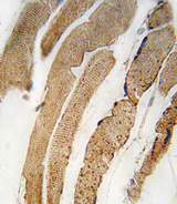 PDK4 Antibody - Formalin-fixed and paraffin-embedded human skeletal muscle tissue reacted with PDK4 antibody (Center D98) , which was peroxidase-conjugated to the secondary antibody, followed by DAB staining. This data demonstrates the use of this antibody for immunohistochemistry; clinical relevance has not been evaluated.