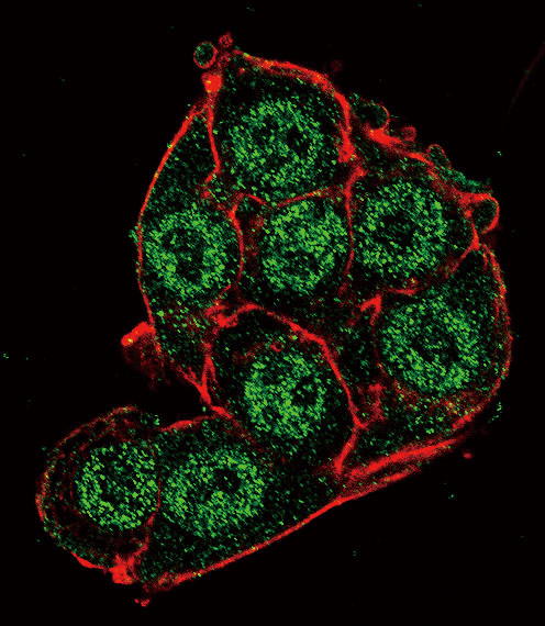 PDK4 Antibody - Confocal immunofluorescence of PDK4 Antibody (Center D98) with HeLa cell followed by Alexa Fluor 488-conjugated goat anti-rabbit lgG (green). Actin filaments have been labeled with Alexa Fluor 555 phalloidin (red).