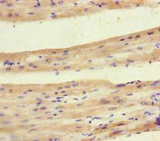 PDK4 Antibody - Immunohistochemistry of paraffin-embedded human heart tissue at dilution of 1:100