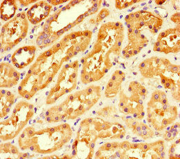 PDK4 Antibody - Immunohistochemistry of paraffin-embedded human kidney tissue at dilution of 1:100