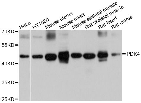 PDK4 Antibody - Western blot analysis of extracts of various cell lines, using PDK4 antibody at 1:1000 dilution. The secondary antibody used was an HRP Goat Anti-Rabbit IgG (H+L) at 1:10000 dilution. Lysates were loaded 25ug per lane and 3% nonfat dry milk in TBST was used for blocking. An ECL Kit was used for detection and the exposure time was 5s.