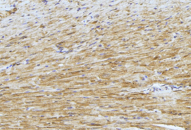 PDK4 Antibody - 1:100 staining mouse muscle tissue by IHC-P. The sample was formaldehyde fixed and a heat mediated antigen retrieval step in citrate buffer was performed. The sample was then blocked and incubated with the antibody for 1.5 hours at 22°C. An HRP conjugated goat anti-rabbit antibody was used as the secondary.