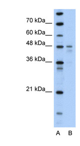 PDK4 Antibody - PDK4 antibody Western blot of Transfected 293T cell lysate. This image was taken for the unconjugated form of this product. Other forms have not been tested.