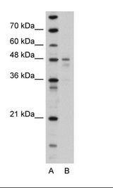PDK4 Antibody - Transfected 293T Cell Lysate.  This image was taken for the unconjugated form of this product. Other forms have not been tested.