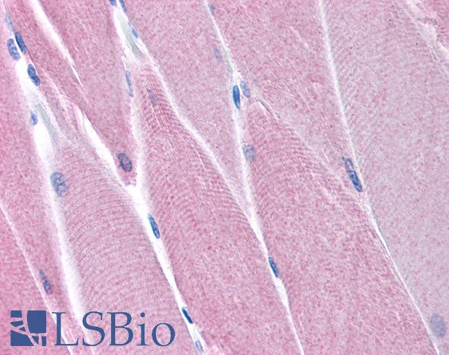 PDK4 Antibody - Anti-PDK4 antibody IHC of human skeletal muscle. Immunohistochemistry of formalin-fixed, paraffin-embedded tissue after heat-induced antigen retrieval. Antibody concentration 5 ug/ml.  This image was taken for the unconjugated form of this product. Other forms have not been tested.