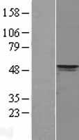 PDK4 Protein - Western validation with an anti-DDK antibody * L: Control HEK293 lysate R: Over-expression lysate