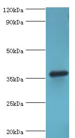 PDLIM1 Antibody - Western blot. All lanes: PDZ and LIM domain protein 1 antibody at 2 ug/ml+HepG2 whole cell lysate. Secondary antibody: Goat polyclonal to rabbit at 1:10000 dilution. Predicted band size: 36 kDa. Observed band size: 36 kDa Immunohistochemistry.