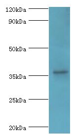PDLIM1 Antibody - Western blot. All lanes: PDZ and LIM domain protein 1 antibody at 10 ug/ml+mouse lung tissue. Secondary antibody: Goat polyclonal to rabbit at 1:10000 dilution. Predicted band size: 36 kDa. Observed band size: 36 kDa Immunohistochemistry.
