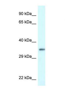 PDLIM1 Antibody - PDLIM1 antibody Western blot of HeLa Cell lysate. Antibody concentration 1 ug/ml.  This image was taken for the unconjugated form of this product. Other forms have not been tested.