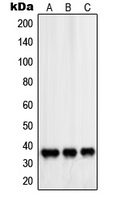 PDLIM1 Antibody - Western blot analysis of PDLIM1 expression in HeLa (A); Saos2 (B); NIH3T3 (C) whole cell lysates.