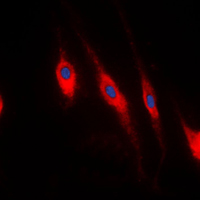 PDLIM1 Antibody - Immunofluorescent analysis of PDLIM1 staining in HeLa cells. Formalin-fixed cells were permeabilized with 0.1% Triton X-100 in TBS for 5-10 minutes and blocked with 3% BSA-PBS for 30 minutes at room temperature. Cells were probed with the primary antibody in 3% BSA-PBS and incubated overnight at 4 C in a humidified chamber. Cells were washed with PBST and incubated with a DyLight 594-conjugated secondary antibody (red) in PBS at room temperature in the dark. DAPI was used to stain the cell nuclei (blue).