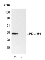 PDLIM1 Antibody - Immunoprecipitation of PDLIM1 from 0.5mg HepG2 whole cell extract lysate using 5ug of Anti-PDLIM1 Antibody and 50ul of protein G magnetic beads (+). No antibody was added to the control (-). The antibody was incubated under agitation with Protein G beads for 10min HepG2 whole cell extract lysate diluted in RIPA buffer was added to each sample and incubated for a further 10min under agitation. Proteins were eluted by addition of 40ul SDS loading buffer and incubated for 10min at 70 C; 10ul of each sample was separated on a SDS PAGE gel transferred to a nitrocellulose membrane blocked with 5% BSA and probed with Anti-PDLIM1 Antibody.