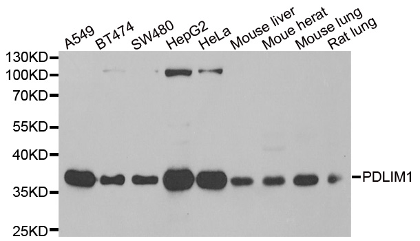 PDLIM1 Antibody - Western blot analysis of extracts of various cell lines.