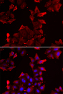 PDLIM1 Antibody - Immunofluorescence analysis of U2OS cells.