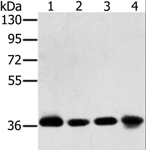 PDLIM1 Antibody - Western blot analysis of Huvec and 293T cell, hepg2 cell and mouse liver tissue, using PDLIM1 Polyclonal Antibody at dilution of 1:600.