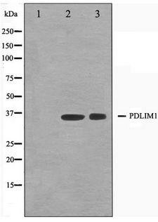 PDLIM1 Antibody - Western blot of K562 and Jurkat cell lysate using CLIM1 Antibody
