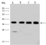 PDLIM1 Antibody - Anti-PDLIM1 rabbit polyclonal antibody at 1:500 dilution. Lane A: Jurkat Whole Cell Lysate. Lane B: HeLa Whole Cell Lysate. Lane C: 293T Whole Cell Lysate. Lane D: Caco-2 Whole Cell Lysate. Lysates/proteins at 30 ug per lane. Secondary: Goat Anti-Rabbit IgG (H+L)/HRP at 1/10000 dilution. Developed using the ECL technique. Performed under reducing conditions. Predicted band size: 36 kDa. Observed band size: 36 kDa.