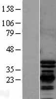 PDLIM1 Protein - Western validation with an anti-DDK antibody * L: Control HEK293 lysate R: Over-expression lysate