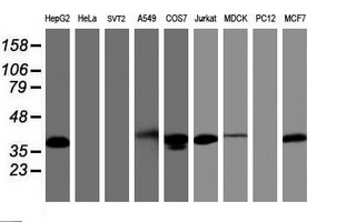 PDLIM2 / SLIM Antibody - Western blot of extracts (35 ug) from 9 different cell lines by using anti-PDLIM2 monoclonal antibody.