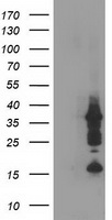 PDLIM2 / SLIM Antibody - HEK293T cells were transfected with the pCMV6-ENTRY control (Left lane) or pCMV6-ENTRY PDLIM2 (Right lane) cDNA for 48 hrs and lysed. Equivalent amounts of cell lysates (5 ug per lane) were separated by SDS-PAGE and immunoblotted with anti-PDLIM2.