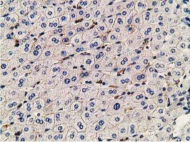 PDLIM2 / SLIM Antibody - IHC of paraffin-embedded Human liver tissue using anti-PDLIM2 mouse monoclonal antibody.