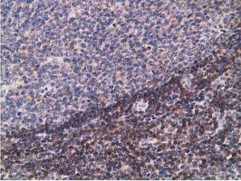 PDLIM2 / SLIM Antibody - IHC of paraffin-embedded Human lymph node tissue using anti-PDLIM2 mouse monoclonal antibody.